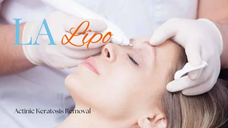 Woman receiving Actinic Keratosis Removal Treatment Biggleswade