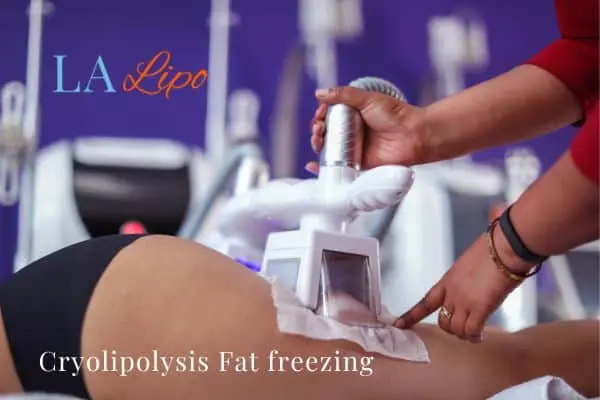 women getting fat freezing Biggleswade