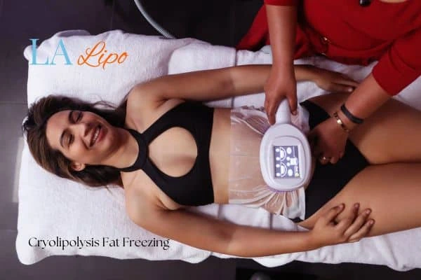 woman getting cryolipolysis Biggleswade