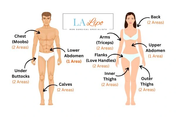 LA LIPO Cryolipolysis Areas Biggleswade