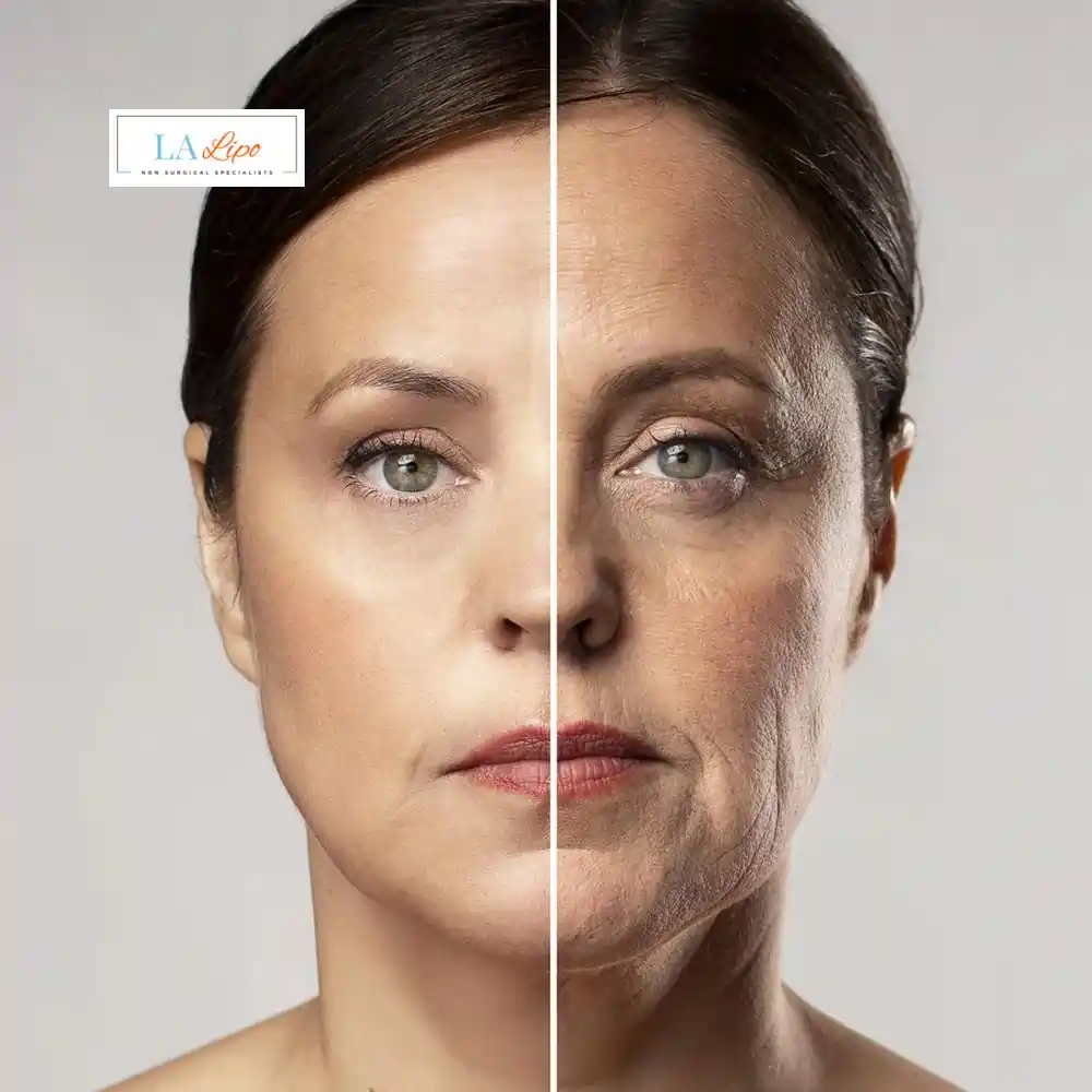 How Can You Tell If Non-Surgical Skin Tightening Is Right for You Biggleswade?