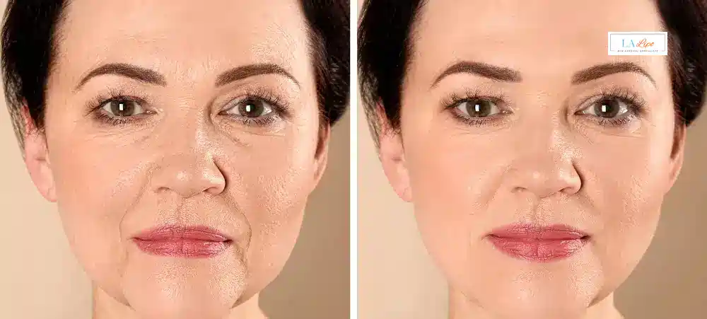 How Long Does It Take to See Results and How Long Do They Last Biggleswade?
