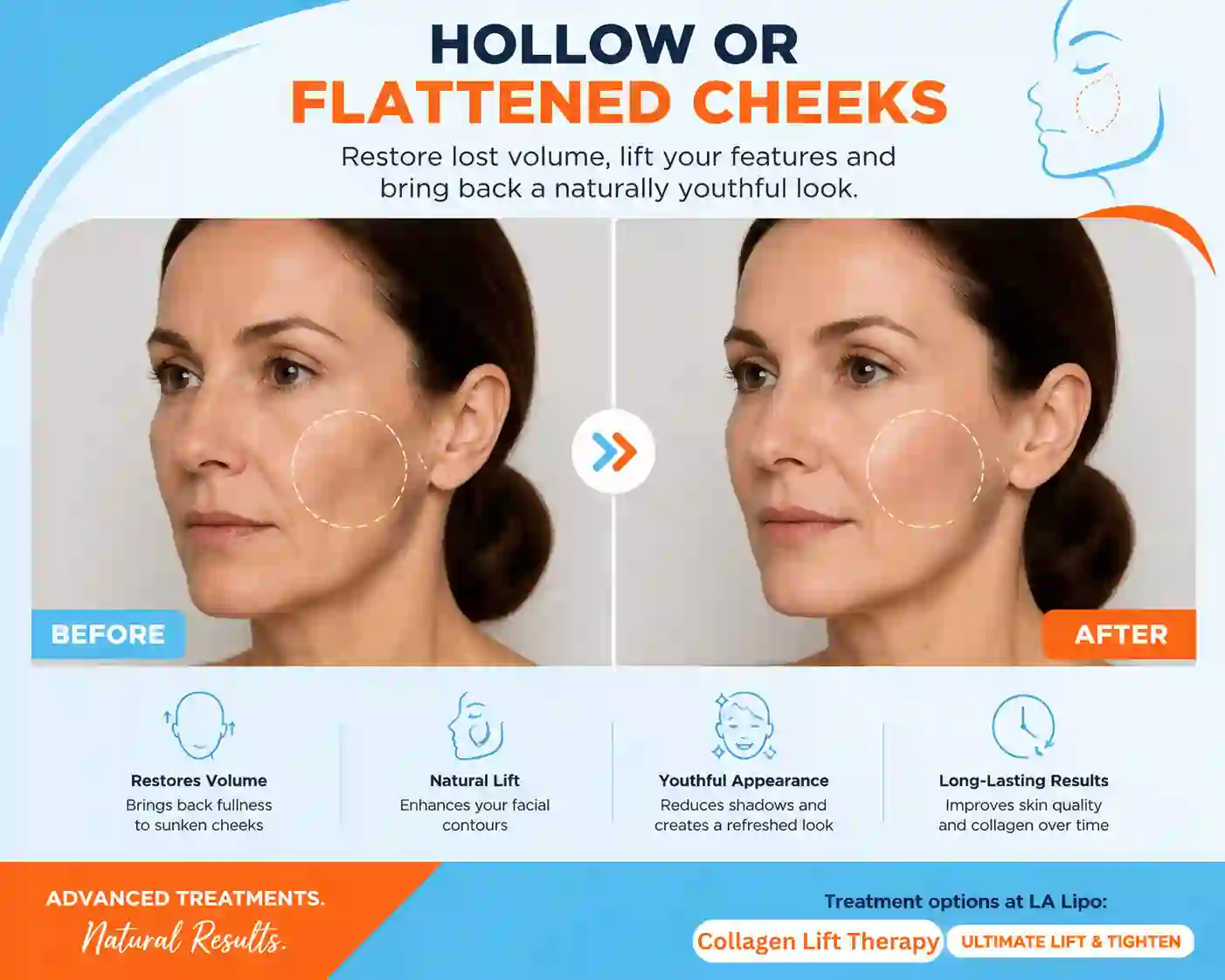 Sign #4: Hollow or Flattened Cheeks Biggleswade