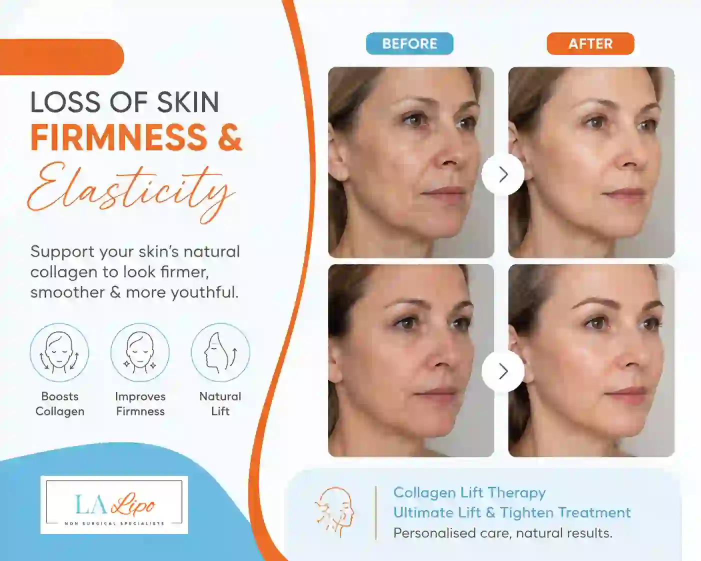 Sign #7: Loss of Skin Firmness and Elasticity Biggleswade