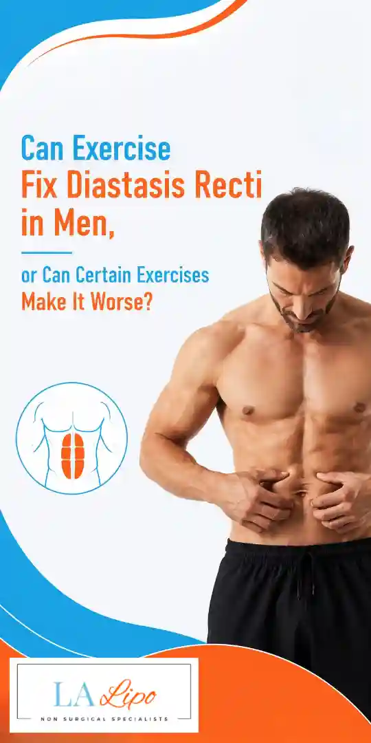 Can Exercise Fix Diastasis Recti in Men, or Can Certain Exercises Make It Worse Biggleswade?