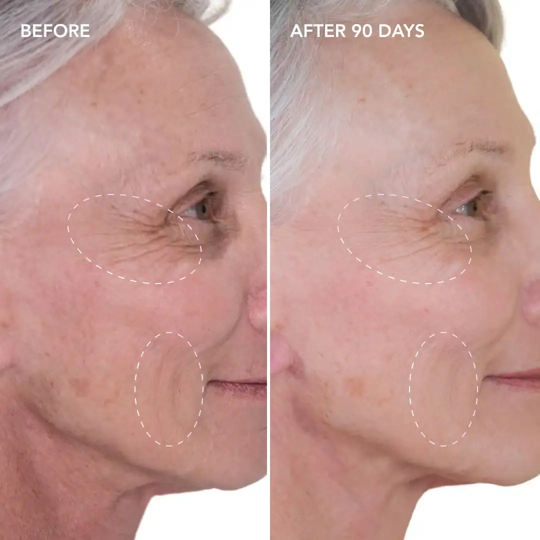 When will you see results Biggleswade